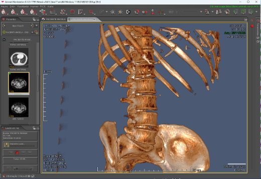 Reconstrução 3D
